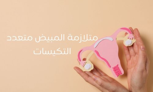 Syndrome des ovaires polykystiques